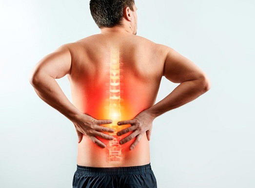 sciatica treatment in Miami